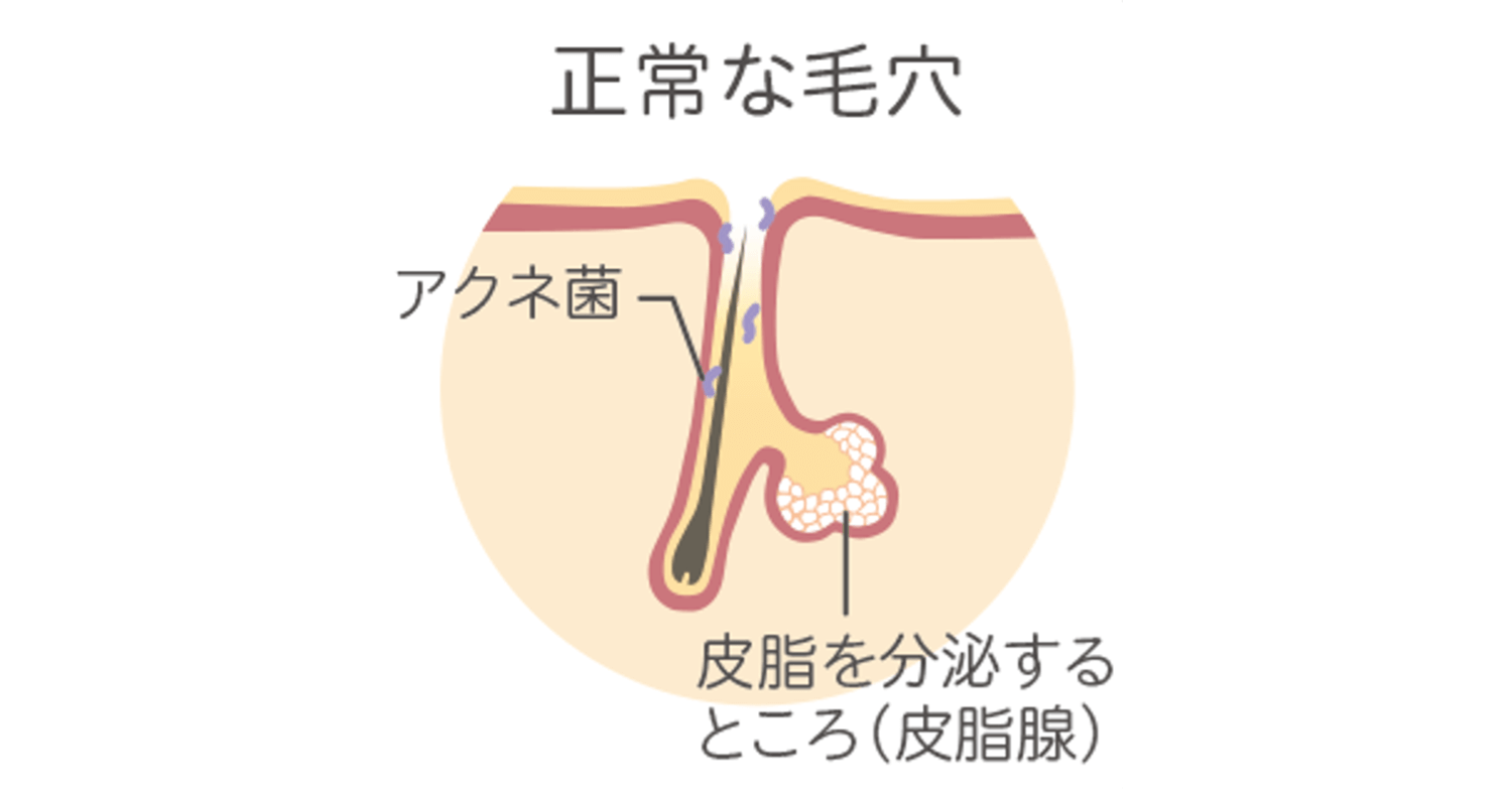 draw1