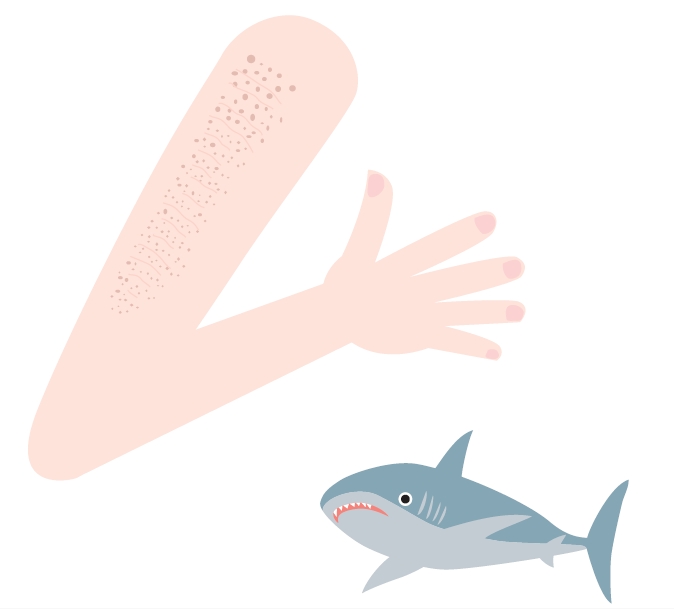 Q 腕がザラザラ サメ肌です 治療できますか 立川 今井皮フ形成外科クリニック